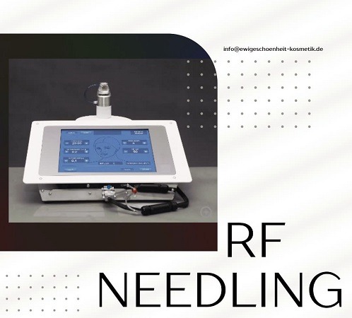 Die Königsklasse des Microneedlings: Radiofrequenz-Needling